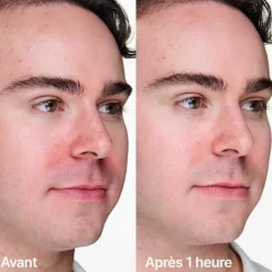 Clinique Visage^Anti-blemish Solutions™