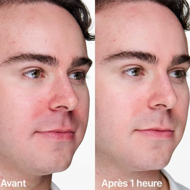 Clinique Visage^Anti-blemish Solutions™