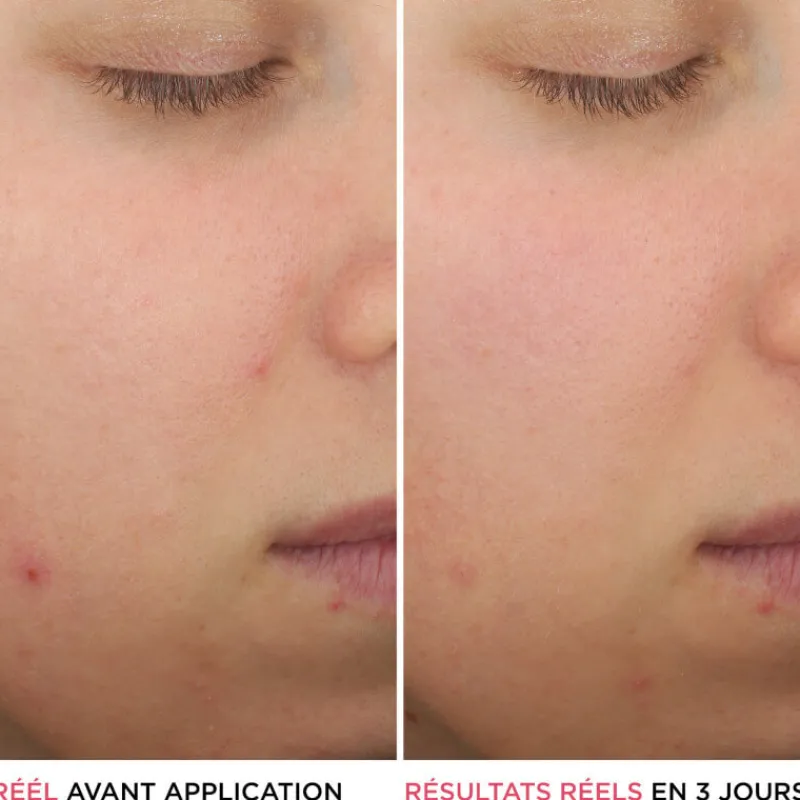 IT COSMETICS Visage^Bye Bye Breakout