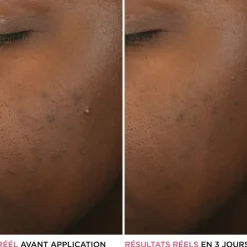 IT COSMETICS Visage^Bye Bye Breakout