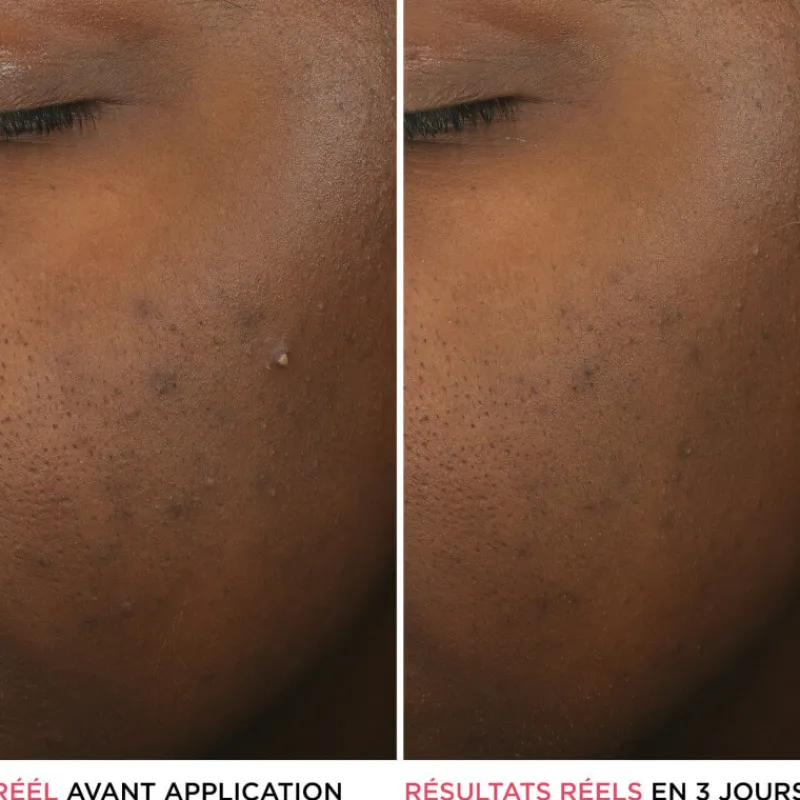 IT COSMETICS Visage^Bye Bye Breakout