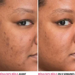 IT COSMETICS Visage^Bye Bye Dark Spots