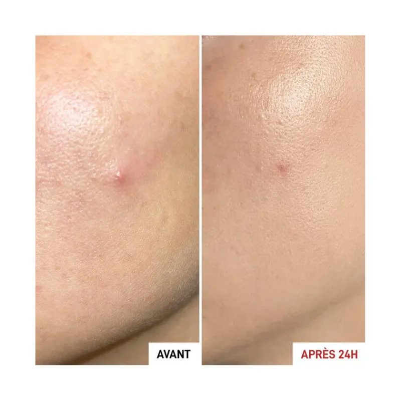 Erborian Visage^Centella Sos Patch