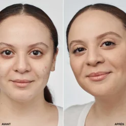 Clinique Teint^Even Better