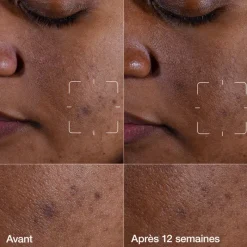 Clinique Visage^Even Better Clinical™