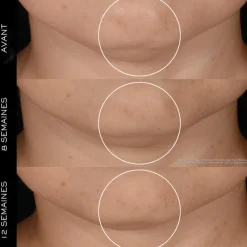 Lancôme Coffret Soin^Rénergie - Coffret 2025