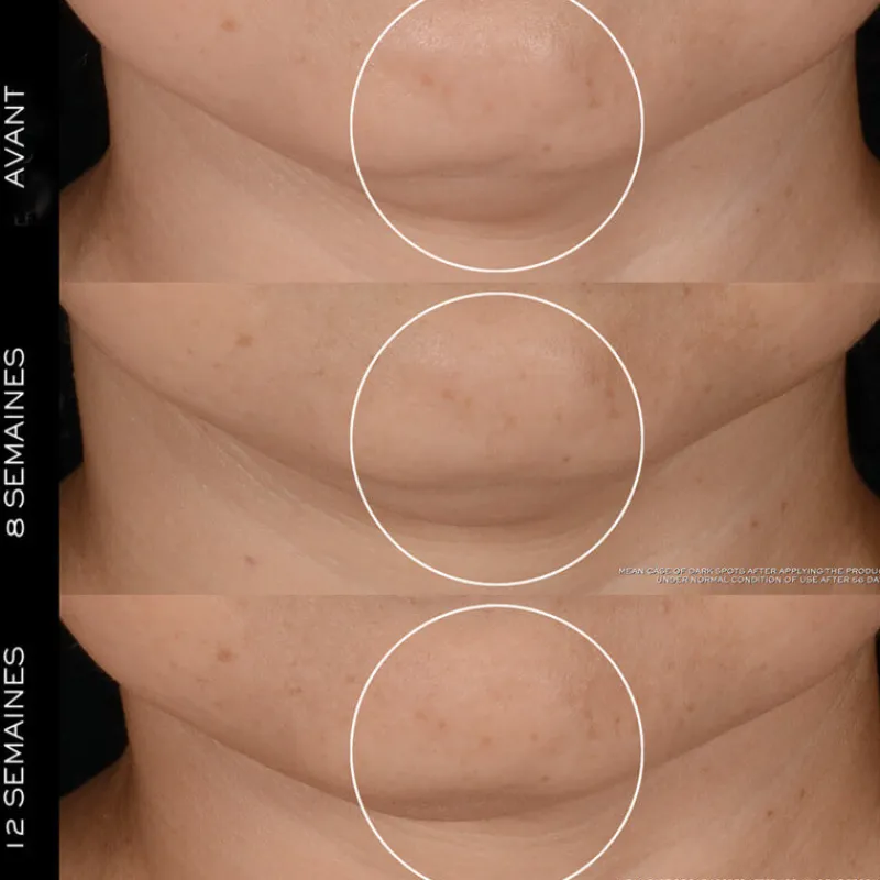 Lancôme Coffret Soin^Rénergie - Coffret 2025