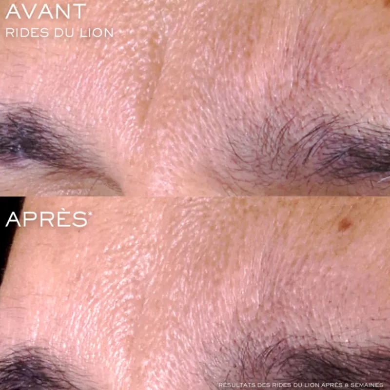 Lancôme Visage^Rénergie C.R.X. Triple Sérum Rétinol