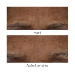 Clinique Visage^Smart Clinical Repair™