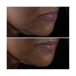 Clinique Visage^Smart Clinical Repair™