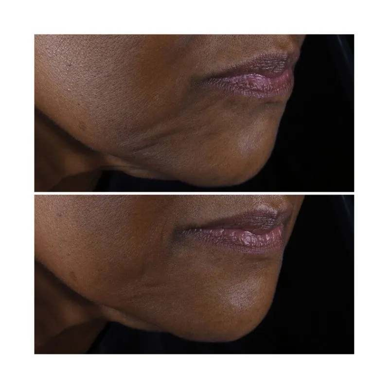 Clinique Visage^Smart Clinical Repair™