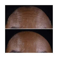 Clinique Visage^Smart Clinical Repair™