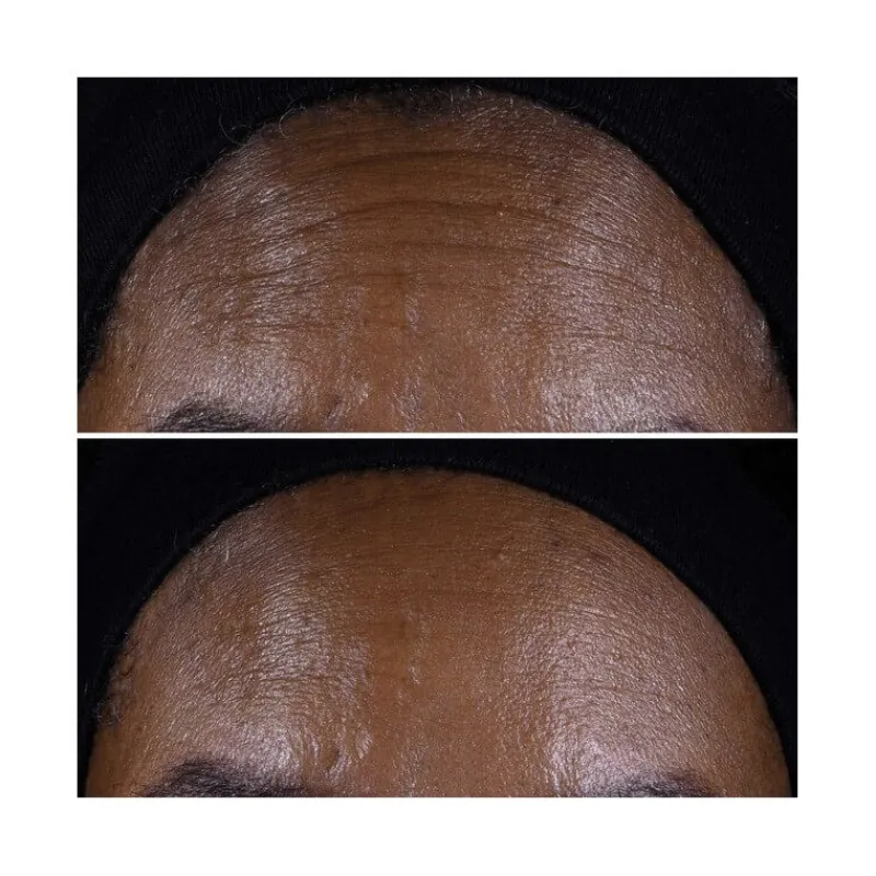 Clinique Visage^Smart Clinical Repair™